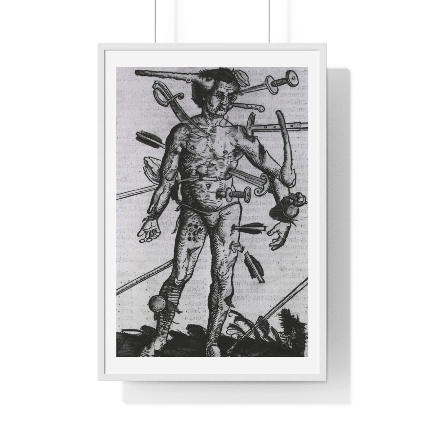 Wound Man (1519) by Hans von Gersdorff from 'Feldtbuch der Wundartzney', from the Original, Framed Print