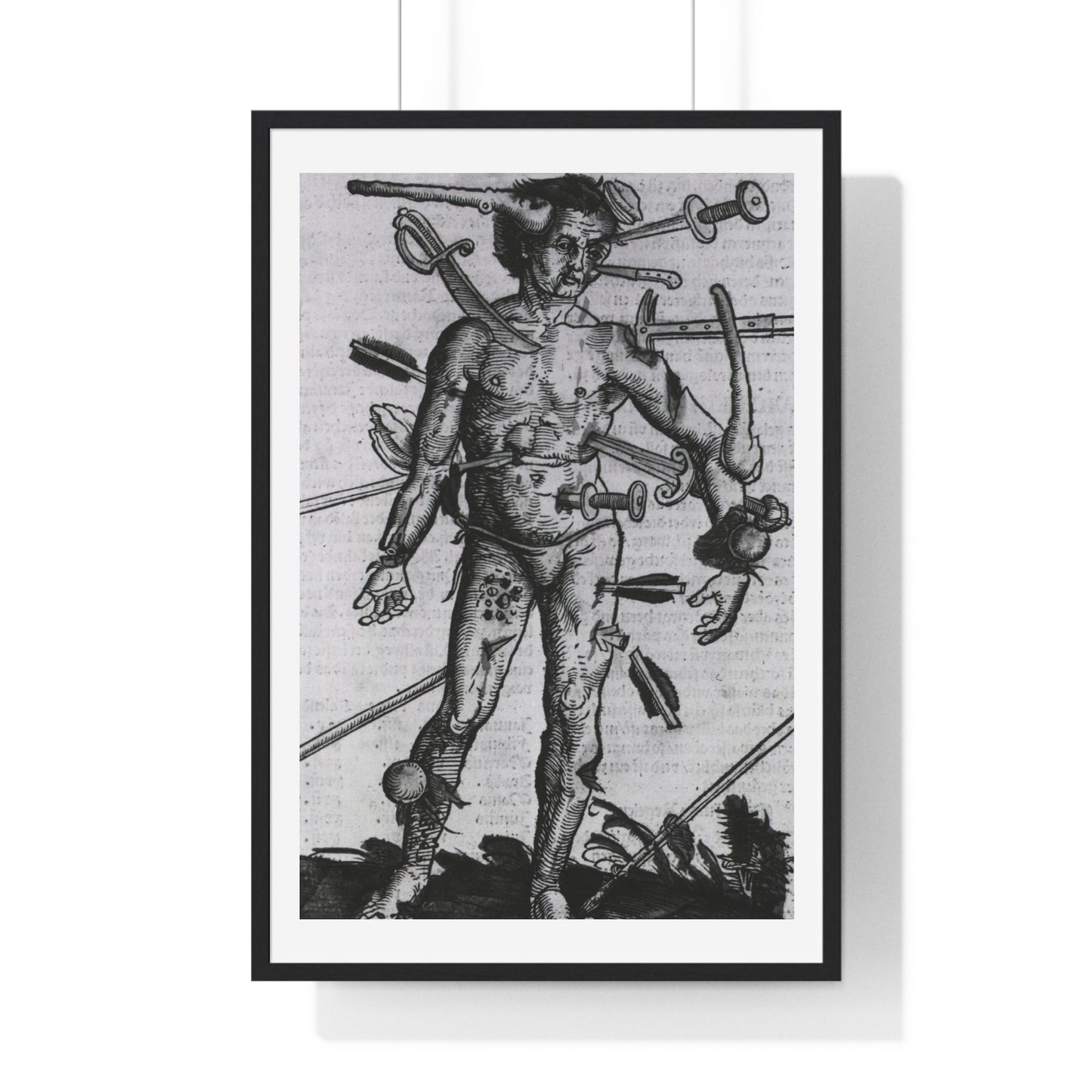 Wound Man (1519) by Hans von Gersdorff from 'Feldtbuch der Wundartzney', from the Original, Framed Print
