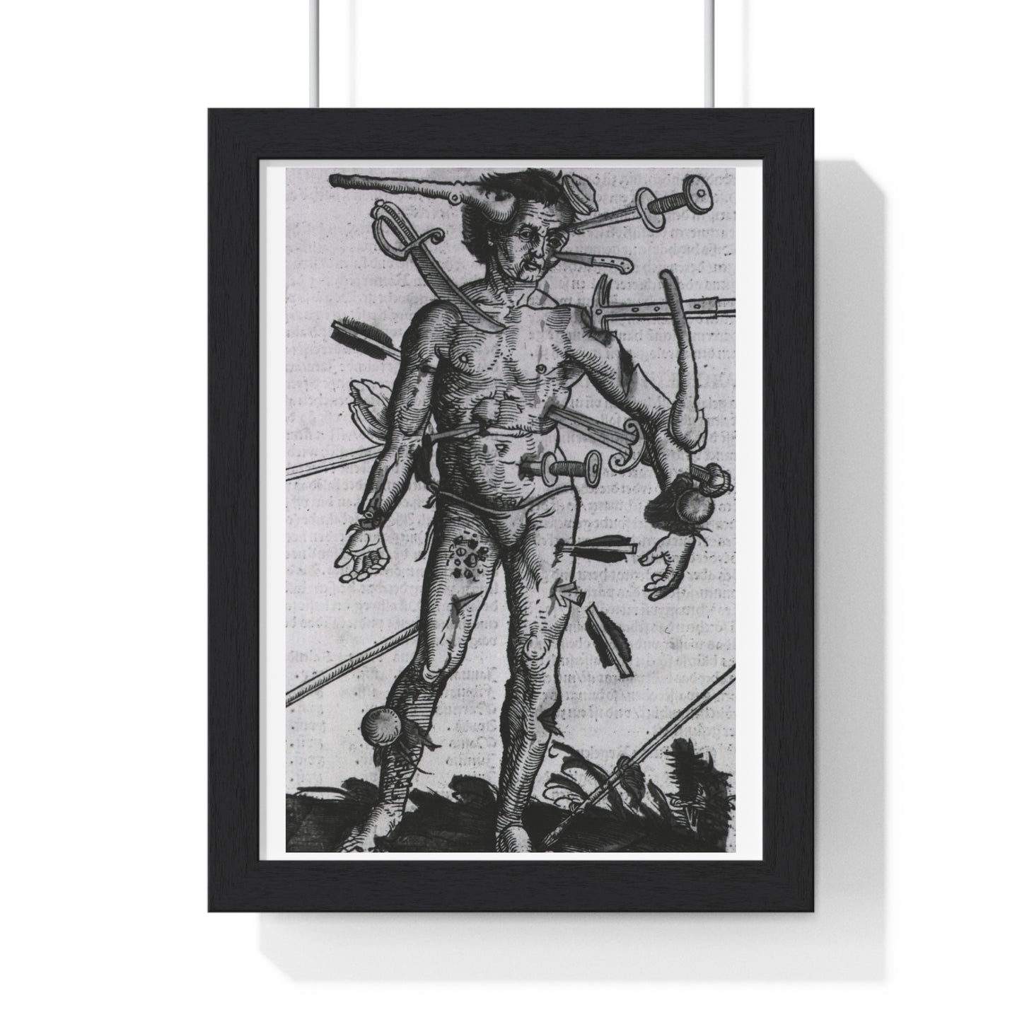 Wound Man (1519) by Hans von Gersdorff from 'Feldtbuch der Wundartzney', from the Original, Framed Print