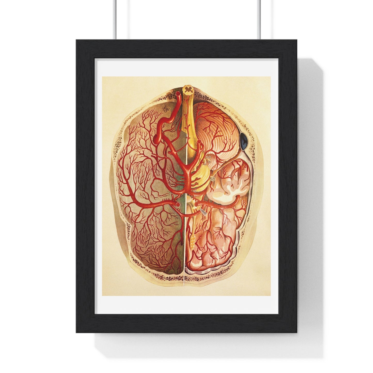 Brain Posterior View, Colour Lithograph by Brocades Great Britain, from the Original, Framed Art Print