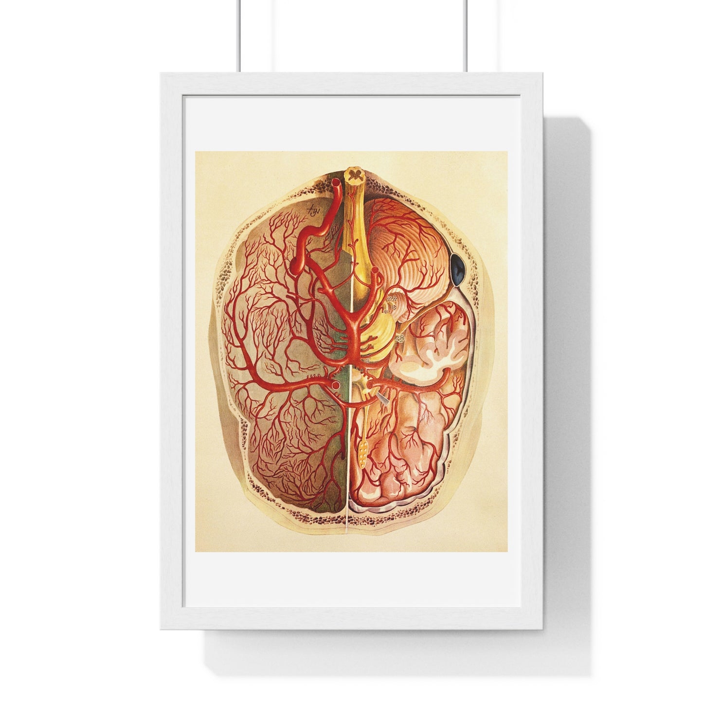 Brain Posterior View, Colour Lithograph by Brocades Great Britain, from the Original, Framed Art Print