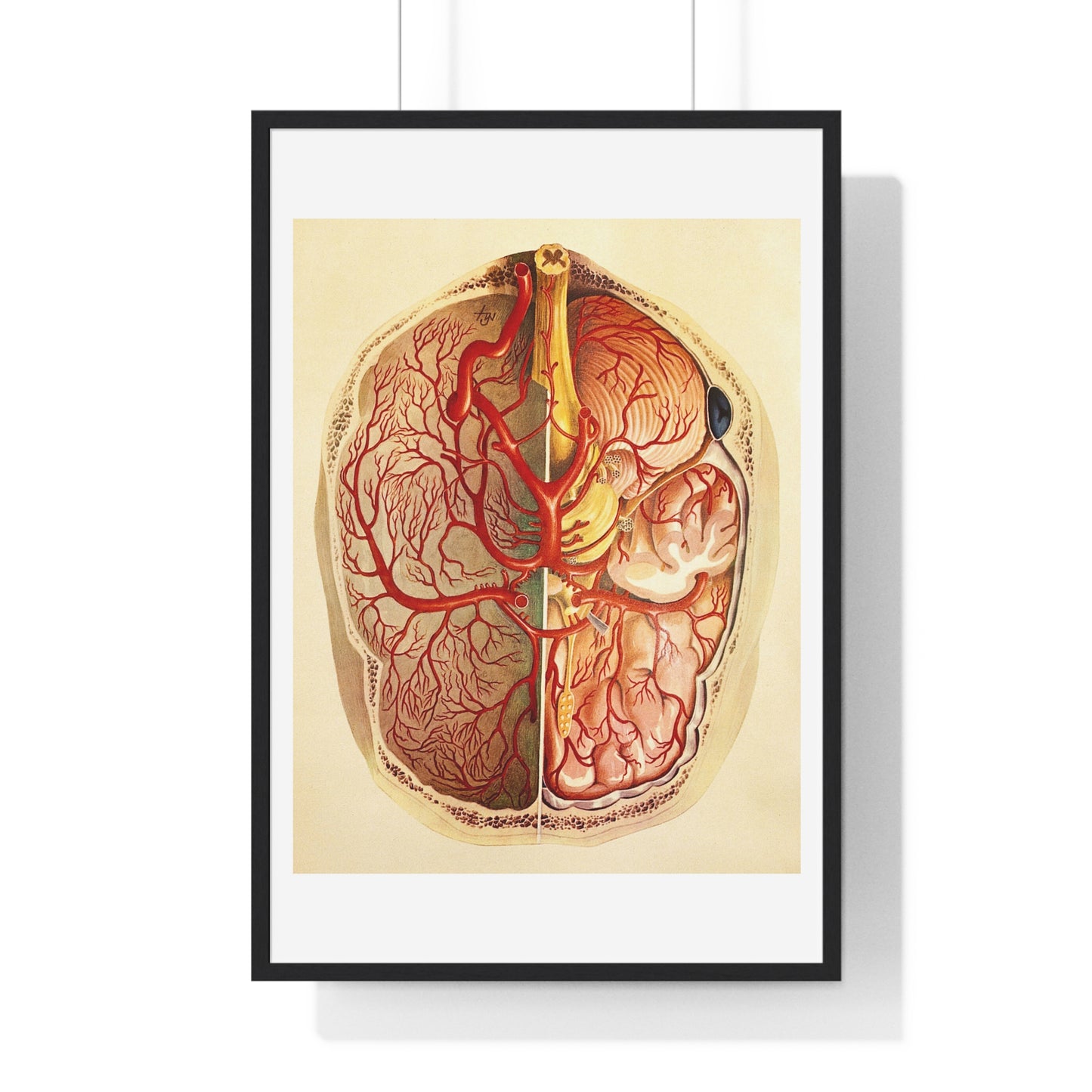 Brain Posterior View, Colour Lithograph by Brocades Great Britain, from the Original, Framed Art Print