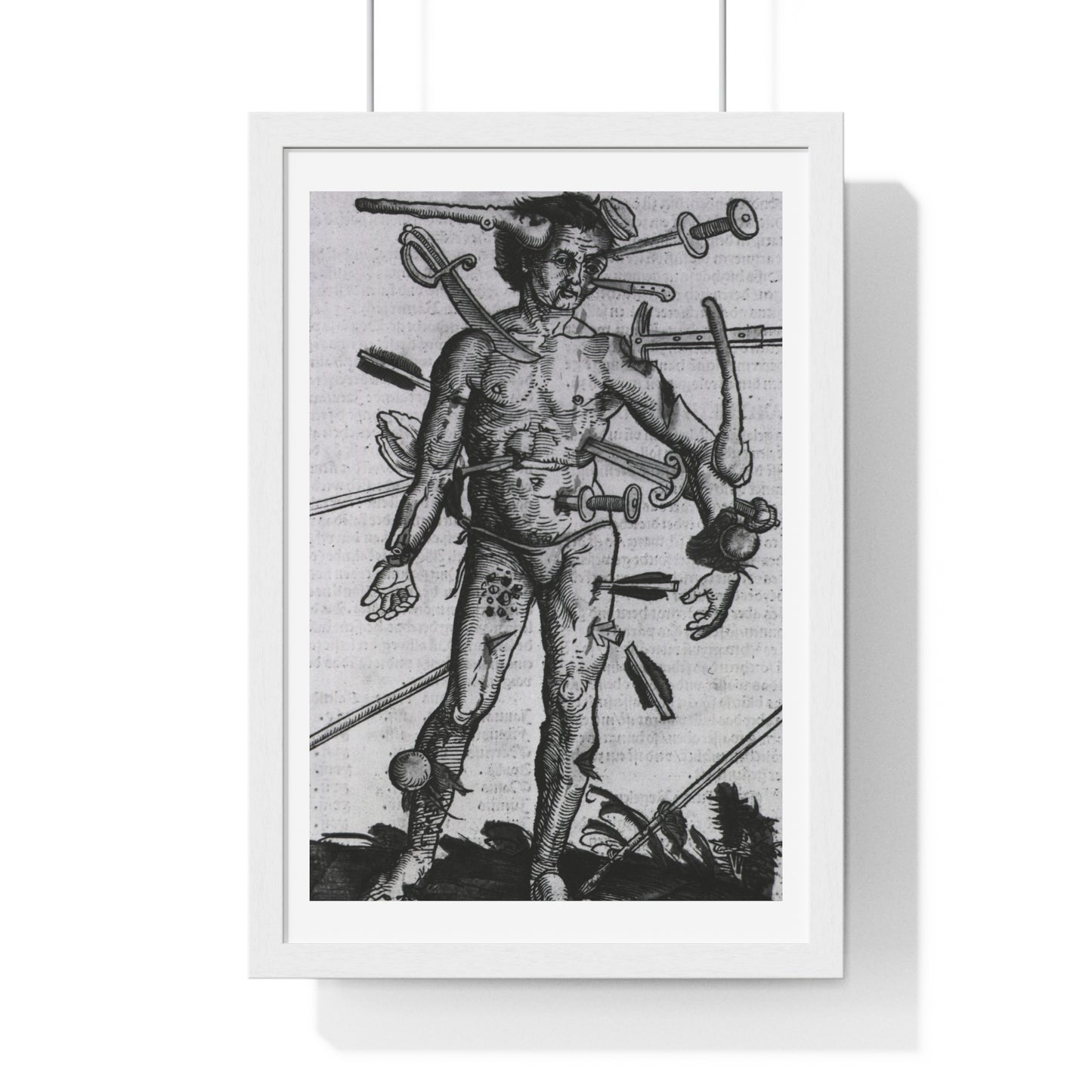 Wound Man (1519) by Hans von Gersdorff from 'Feldtbuch der Wundartzney', from the Original, Framed Print