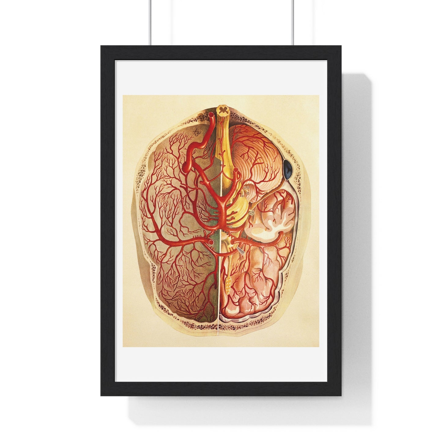 Brain Posterior View, Colour Lithograph by Brocades Great Britain, from the Original, Framed Art Print
