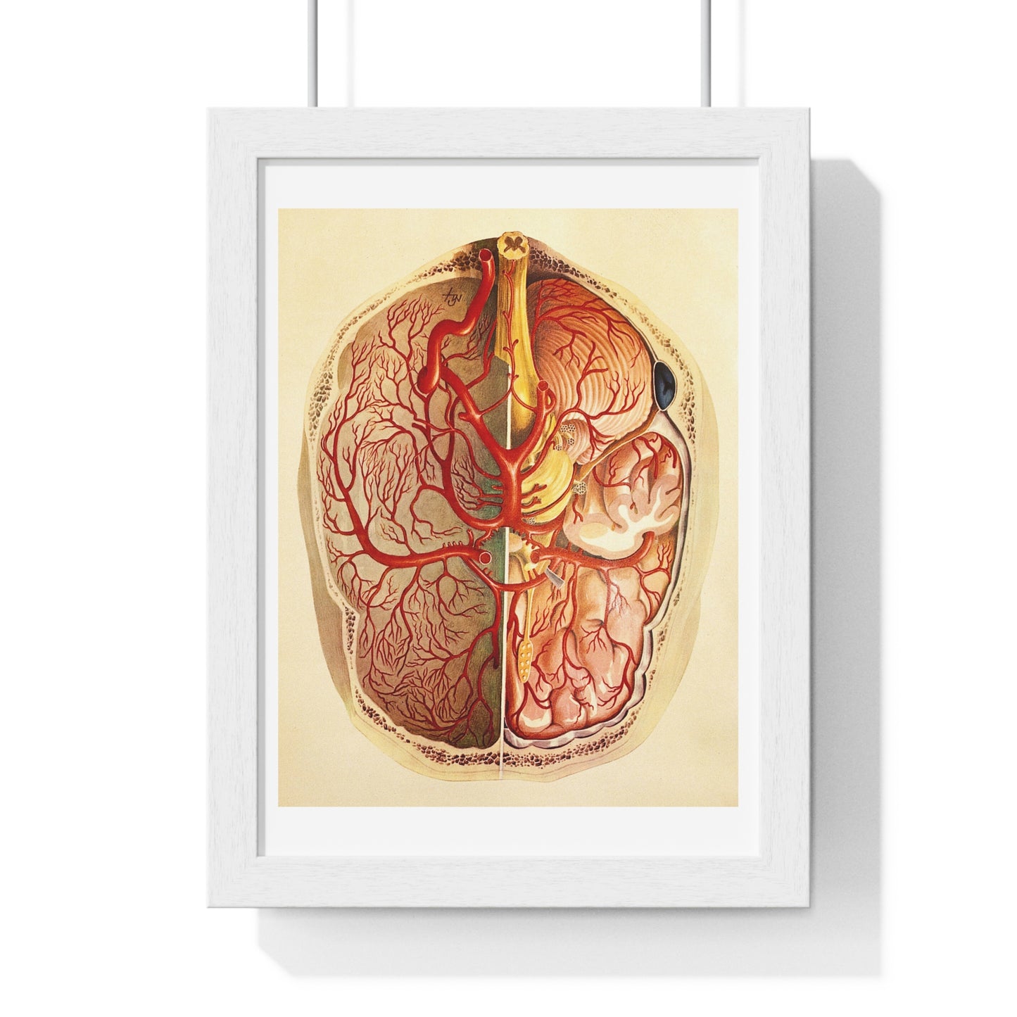Brain Posterior View, Colour Lithograph by Brocades Great Britain, from the Original, Framed Art Print