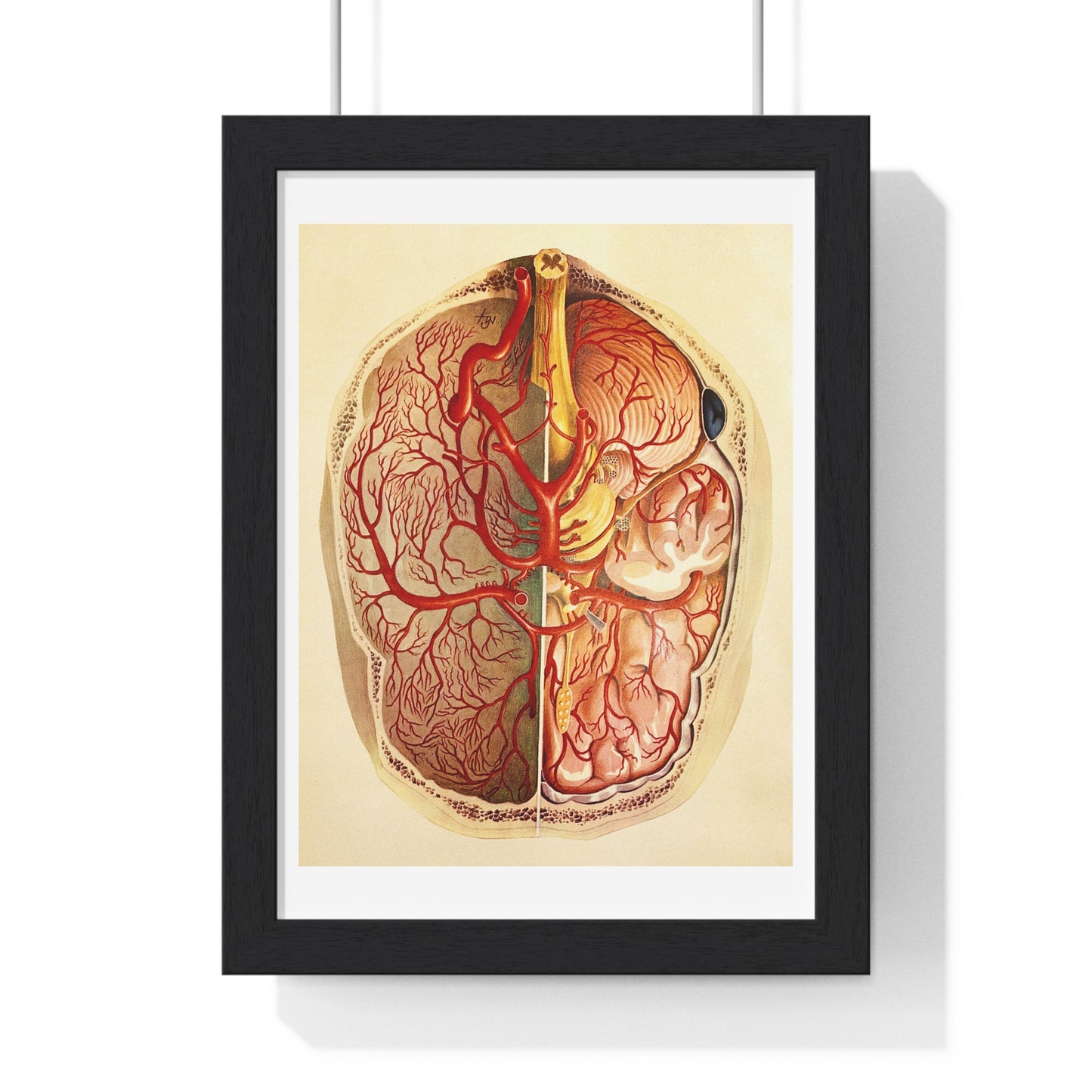 Brain Posterior View, Colour Lithograph by Brocades Great Britain, from the Original,  Framed Art Print