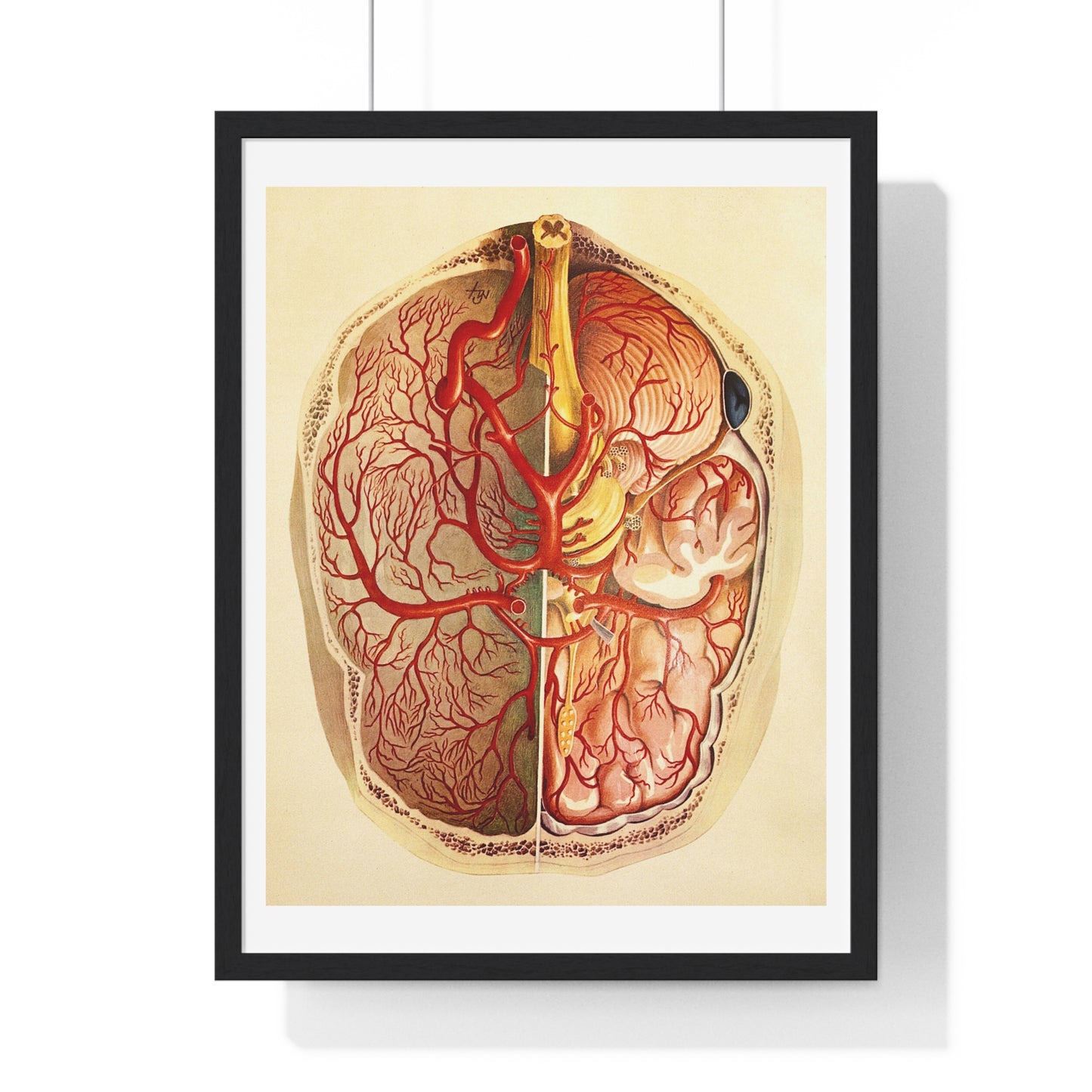 Brain Posterior View, Colour Lithograph by Brocades Great Britain, from the Original,  Framed Art Print