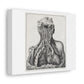 Under The Skin: Anatomy and Identity 19th Century Medical Drawing Print on Satin Canvas