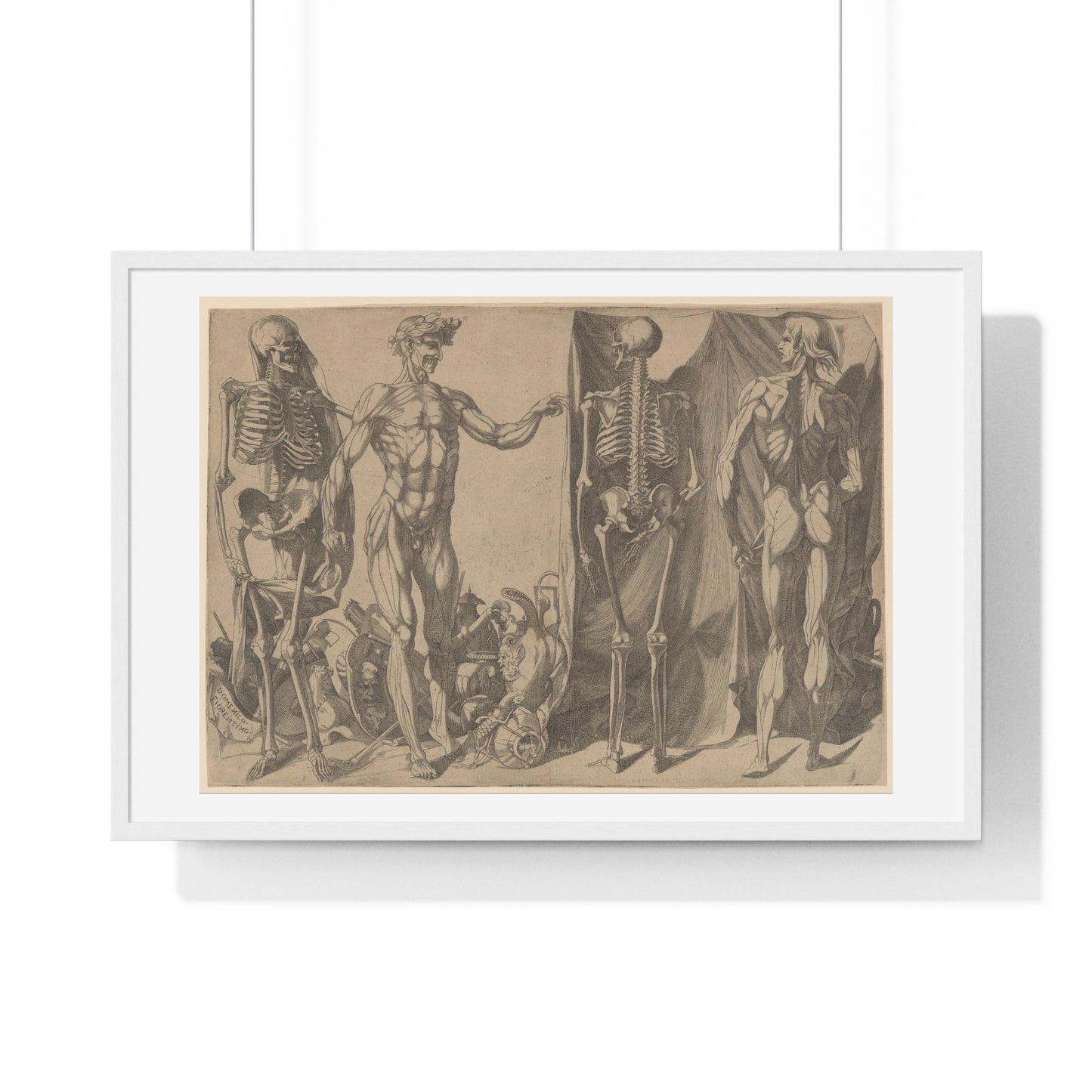 Two Flayed Men and Their Skeletons (1540–1545) by Domenico del Barbiere, from the Original, Framed Art Print