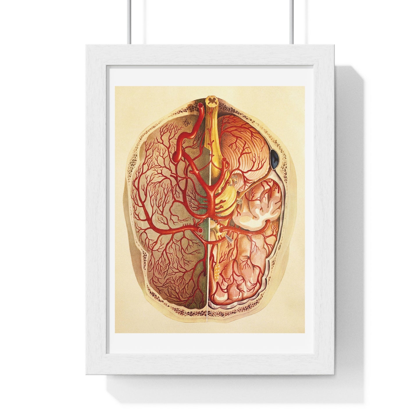 Brain Posterior View, Colour Lithograph by Brocades Great Britain, from the Original,  Framed Art Print