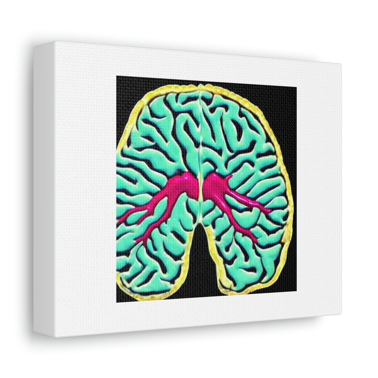 Human Brain With A Computer Chip Inside Digital Art 'Designed by AI' on Canvas